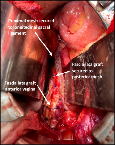 Spotlight On: Urogynecology SIG - NewsScope