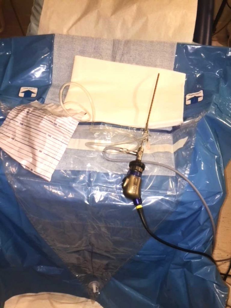 Office Hysteroscopy Simple set up is the best approach NewsScope